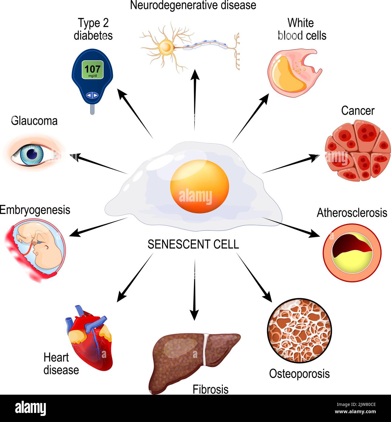 Senescenza cellulare e rischi per la salute. Ruoli che le cellule senescenti svolgono nel corpo umano. Orologio biologico, problemi di invecchiamento, cancro, lesioni e malattie. Illustrazione Vettoriale