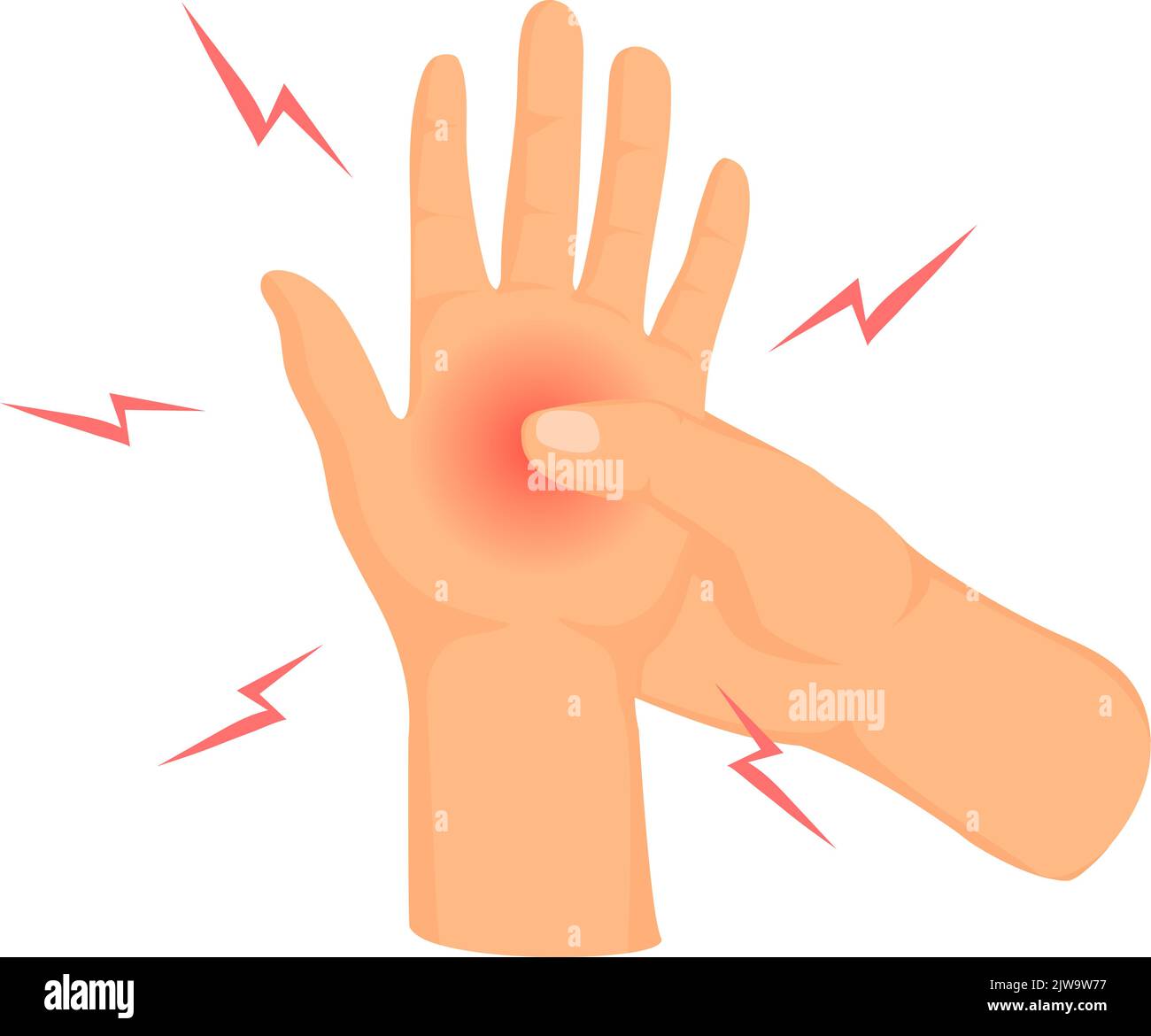 Intorpidimento delle mani. Cartoon intorpidimento mani o articolazioni dolore sensazione, dolore dito formicolio palmo artrite gonfiore braccio danneggiato nervo dolore muscolare tremare e dolori articolari, illustrazione vettore Illustrazione Vettoriale