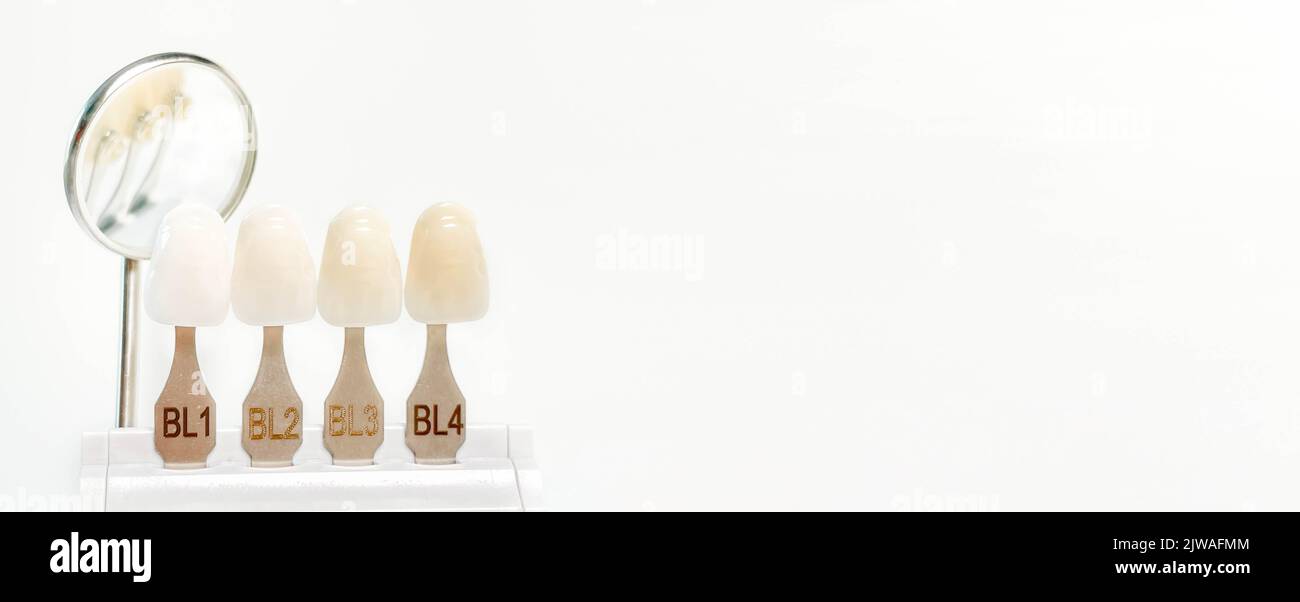 Striscione dentali sbiancamento, sbiancamento, tonalità guida colore candeggina, controllo qualità e controllo colore a dentizione artificiale in laboratorio dentale con Foto Stock