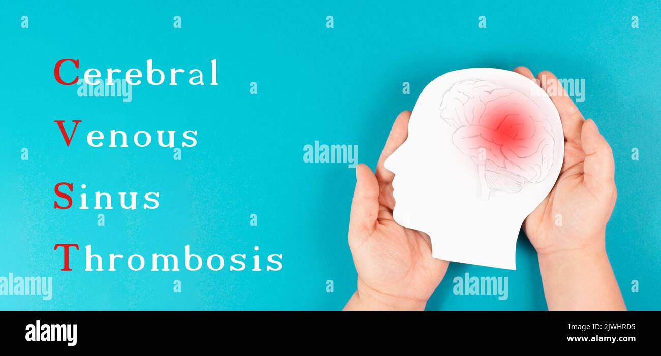 Trombosi venosa cerebrale del seno è in piedi sullo sfondo, Silhouette di una testa con un cervello, coagulo di sangue rosso, effetto collaterale vaccino covid-19 Foto Stock