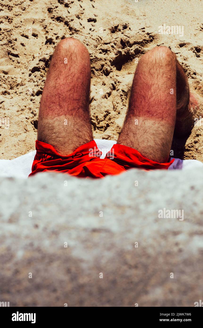 Primo piano delle gambe bruciate di sole dell'uomo non identificabile sulla spiaggia con colpi rossi Foto Stock