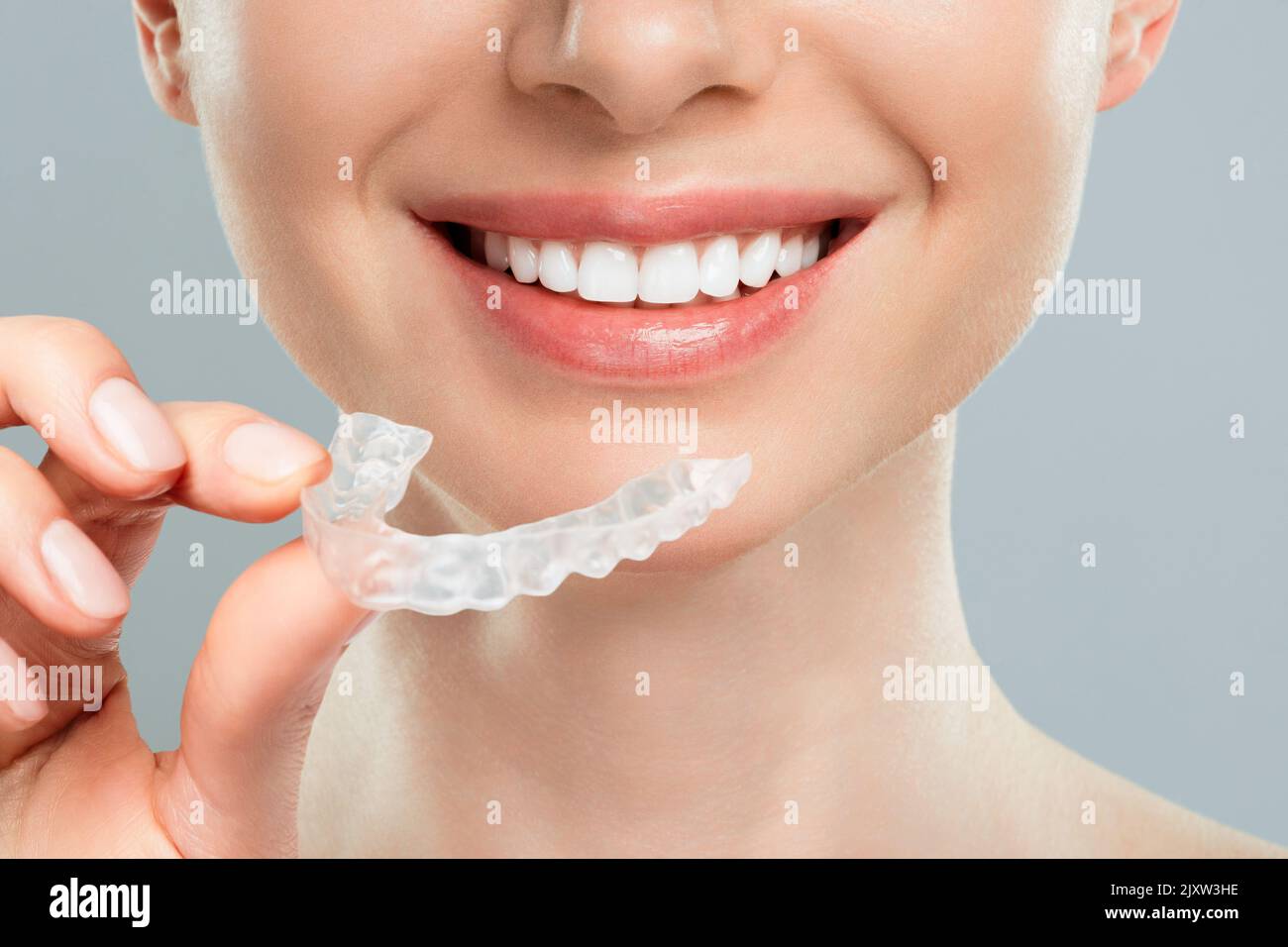 La donna tiene in mano allineatori trasparenti rimovibili e invisibili, e sorride. Foto Stock