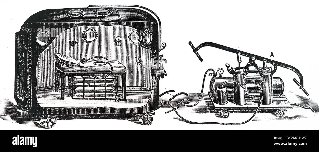 Camera di Fontana per stabilire l'anestesia da protossido di azoto (gas ridente) sotto pressione atmosferica positiva a: Pompa d'aria; b: frigorifero attraverso il quale è stata fatta passare l'aria; c: Camera operativa in lamiera; d: Sacca di gas collegata al facciale. Da Henry M Lyman Artificial Anaesthesia and Anaesthestics, Londra, 1883. Foto Stock