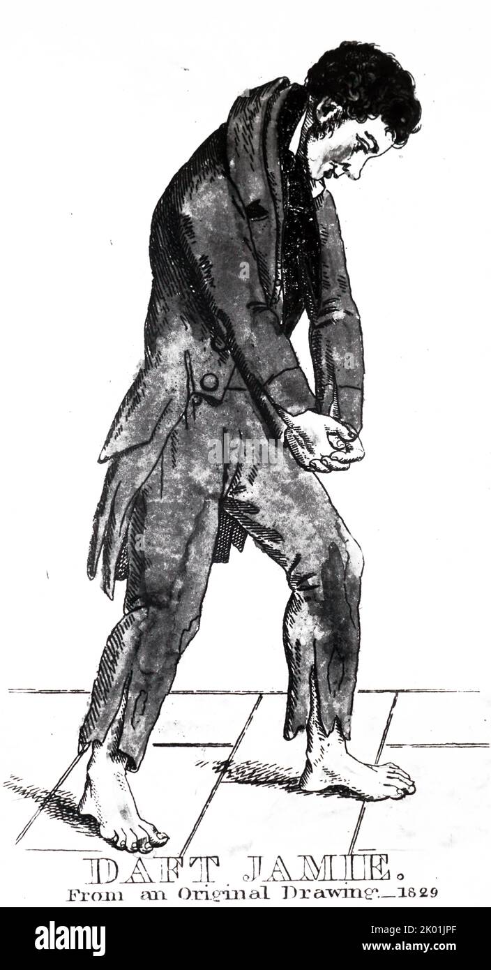 Daft Jamie (James Wilson) una delle vittime di Burke e Hare, il corpo strappatori e assassini. Si impegnarono a fornire cadaveri alla Scuola Medica di Edimburgo e si rivolsero all'omicidio come fonte di approvvigionamento. Le loro attività hanno portato all'approvazione del Anatomy Act del 1832. Foto Stock