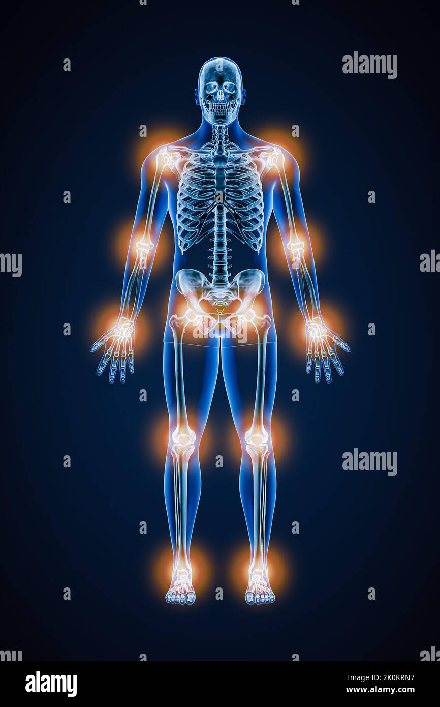 Vista anteriore o anteriore dello scheletro umano con dolore articolare o infiammazione 3D rappresentazione illustrativa. Patologia, anatomia, medicina, sanità, arthitris Foto Stock