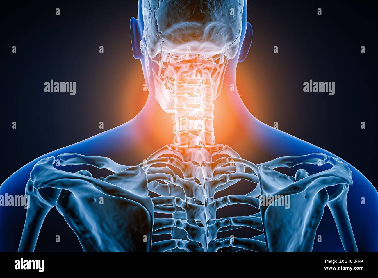 Almencla Modello Colonna Vertebrale Umana 45 Cm Con Bacino E Femore - Colorato Per Studio Medico