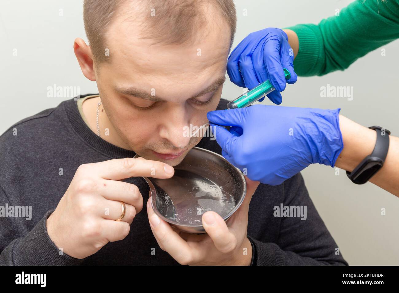 Un infermiere risciacqua la cavità nasale di un paziente affetto da sinusite con soluzione salina utilizzando una siringa. Foto Stock