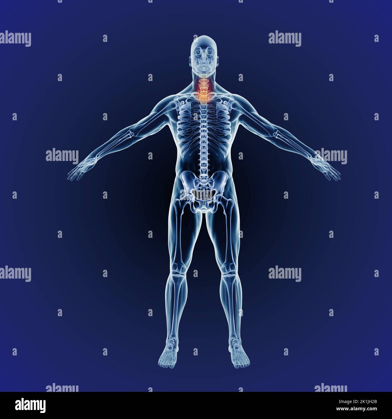 Quando l'infiammazione colpisce. Una rappresentazione cgi a tutta lunghezza del corpo umano indicante la struttura scheletrica. Foto Stock