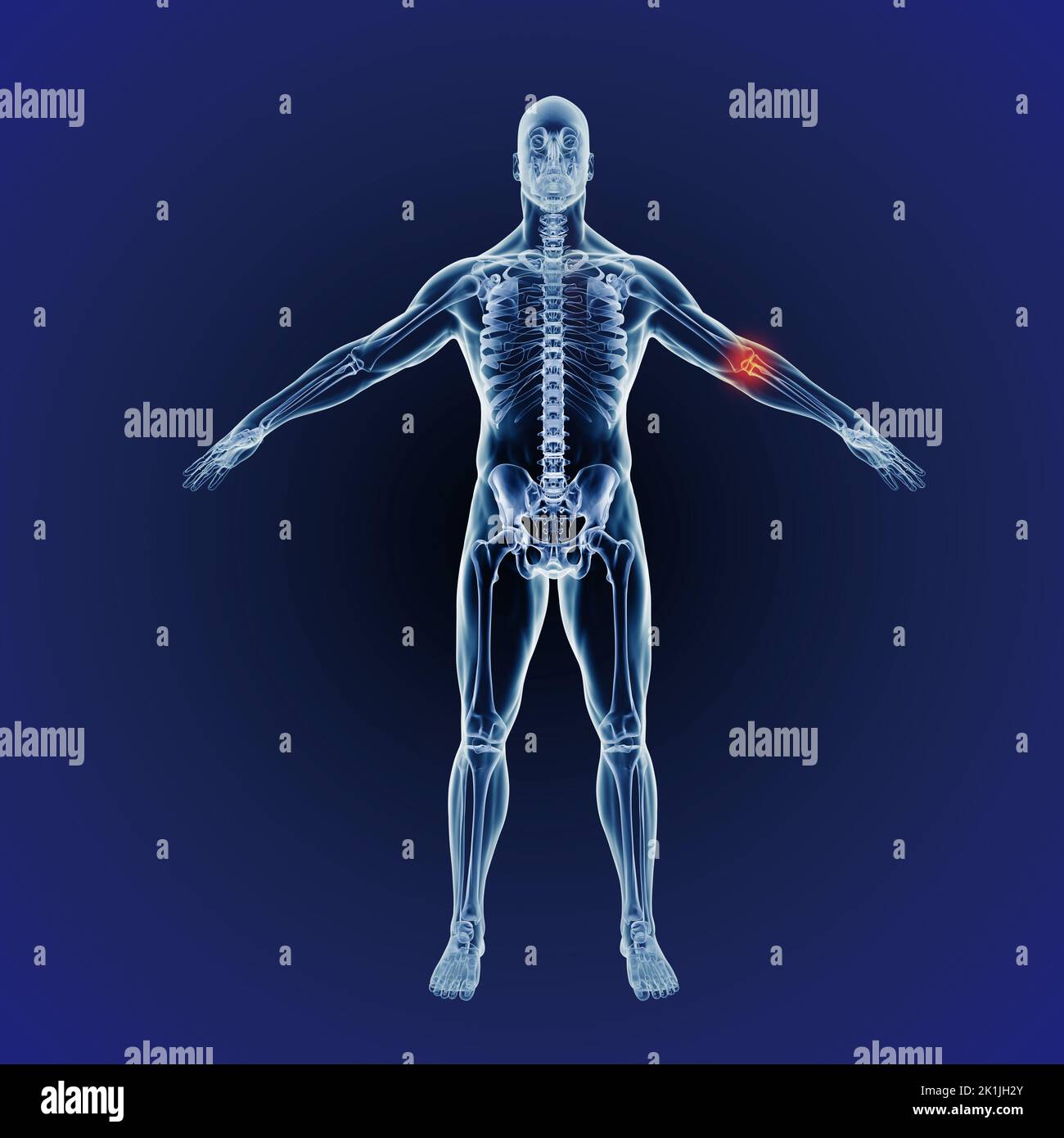Quando l'infiammazione colpisce. Una rappresentazione cgi a tutta lunghezza del corpo umano indicante la struttura scheletrica. Foto Stock