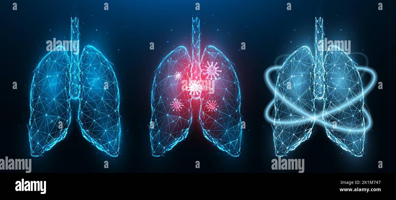 Illustrazione vettoriale poligonale di polmoni umani malati di infiammazione, polmoni sani e recupero della salute polmonare. Sistema respiratorio a bassa poly design. Medico Illustrazione Vettoriale