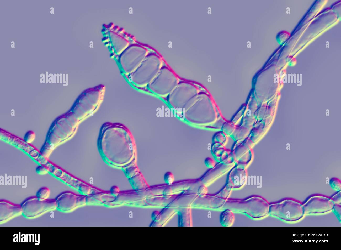 Fungo microsporum audouinii, Foto Stock