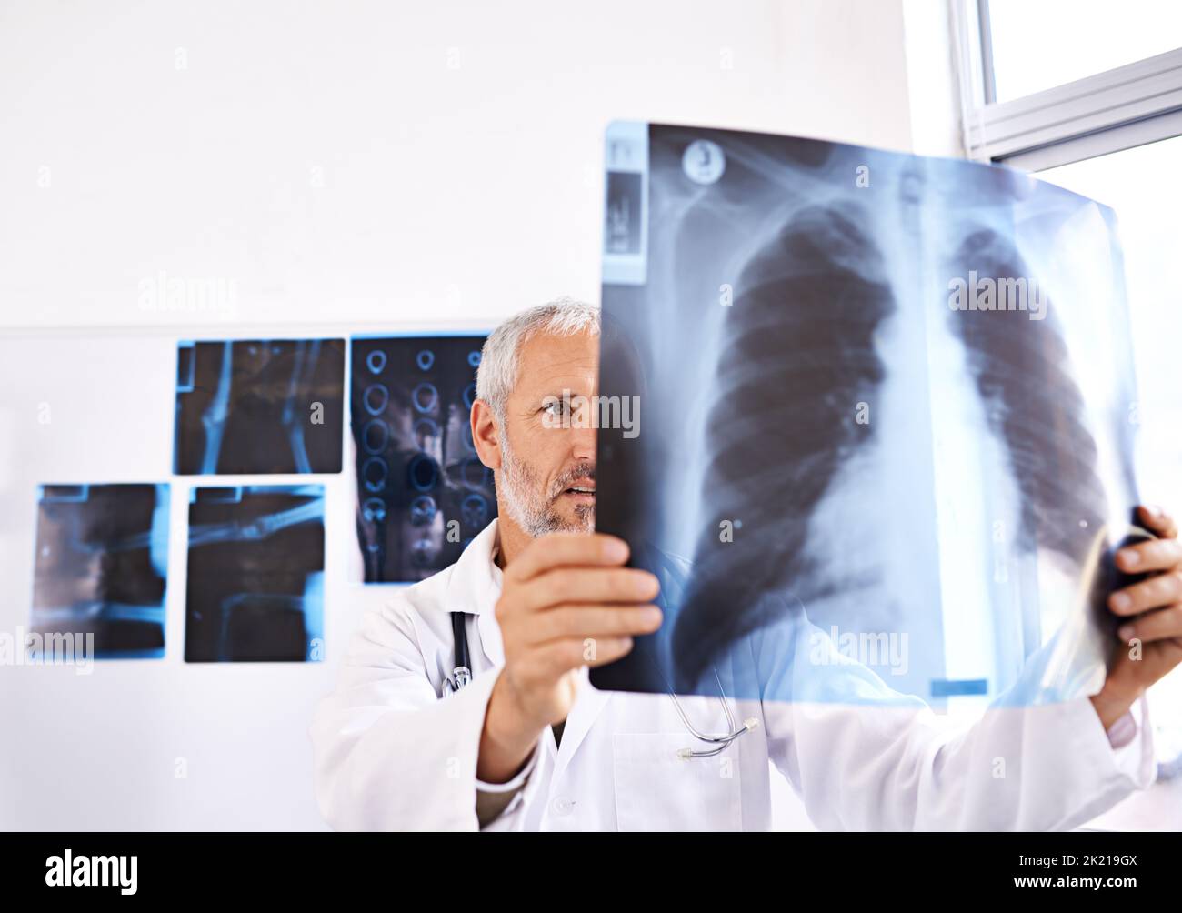 Mi sembra una costola rotta, un medico di sesso maschile maturo che guarda un'immagine radiografica in un ospedale. Foto Stock