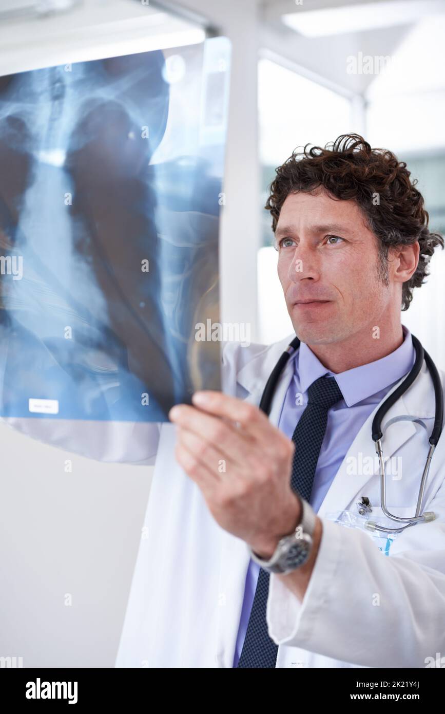 Controllare i raggi X. un medico maschile che guarda i raggi X. Foto Stock