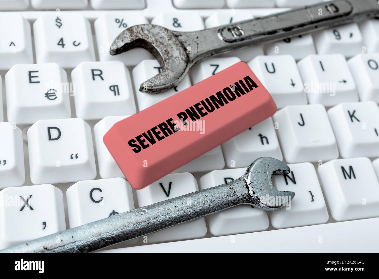 Scrittura a mano testo polmonite grave. Business vetrina malattia acuta che è caratterizzata da infiammazione del tessuto polmonare scaricare file e dati online, Caricamento dei codici di programmazione Foto Stock