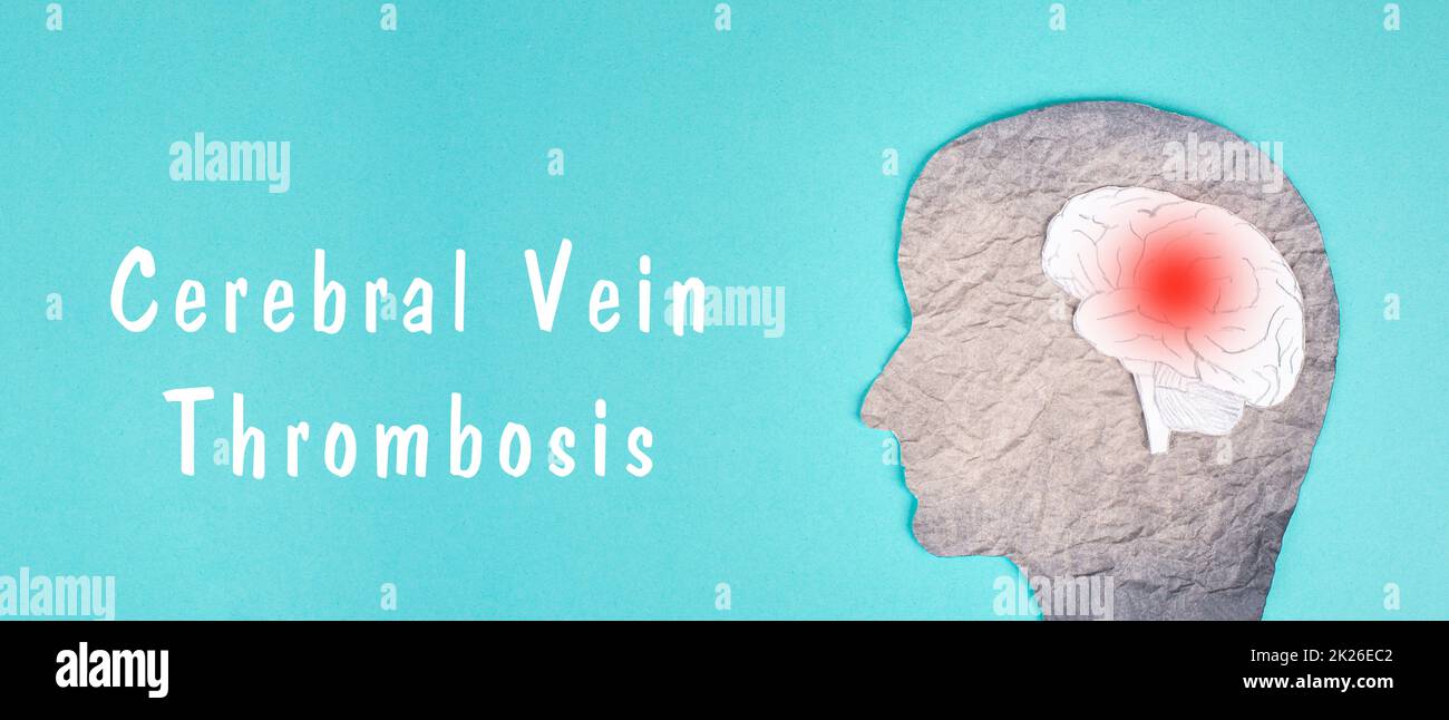 Trombosi venosa cerebrale è in piedi su uno sfondo di colore blu, Silhouette di una testa con un cervello, coagulo di sangue rosso, effetto collaterale vaccino covid-19 Foto Stock