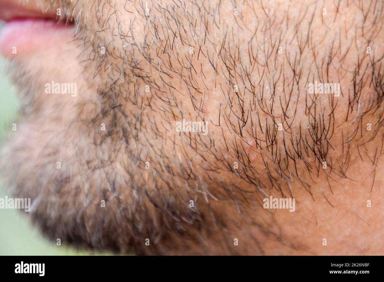 Mento maschio bearded. Barba sul volto di un giovane. Foto Stock