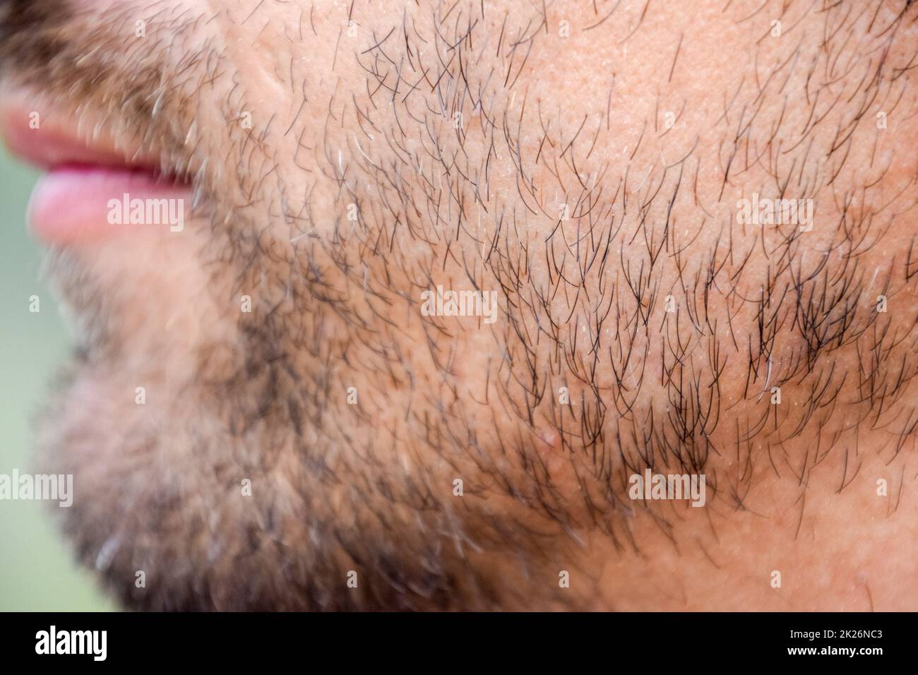 Mento maschio bearded. Barba sul volto di un giovane. Foto Stock