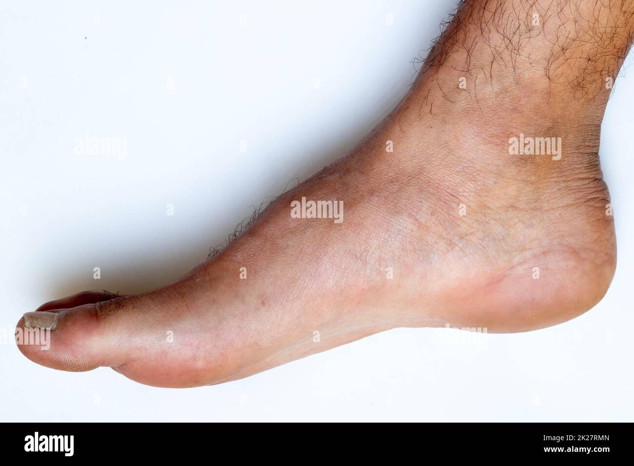 Dita dei piedi, mani e unghie. Parti del corpo umano maschile di età compresa tra 20 e 30 anni Foto Stock