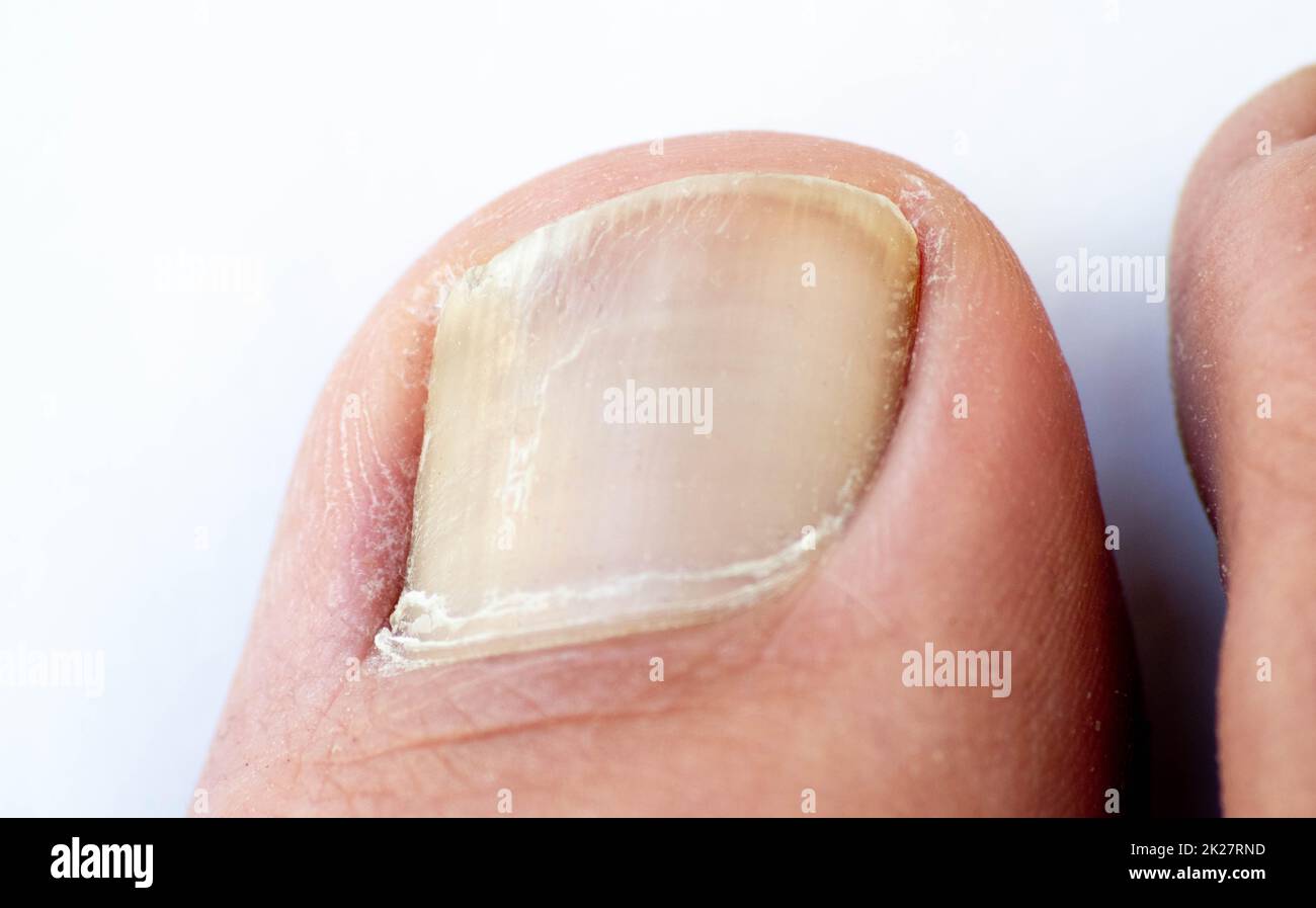 Dita dei piedi, mani e unghie. Parti del corpo umano maschile di età compresa tra 20 e 30 anni Foto Stock