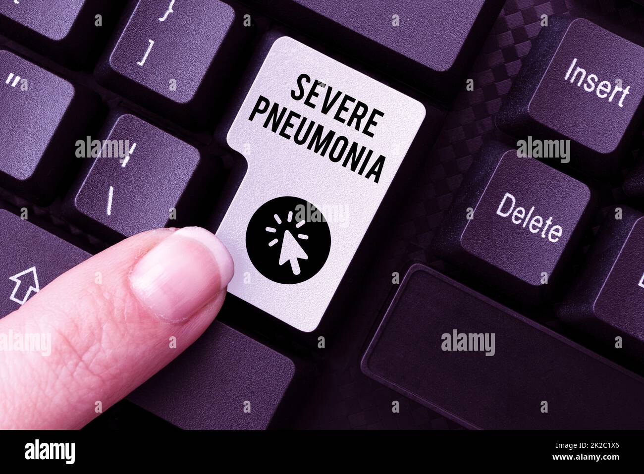 Scrittura a mano segno grave polmonite. Foto concettuale malattia acuta che è caratterizzata da infiammazione del tessuto polmonare riempire i moduli di registrazione online, raccolta e modifica dei dati Internet Foto Stock