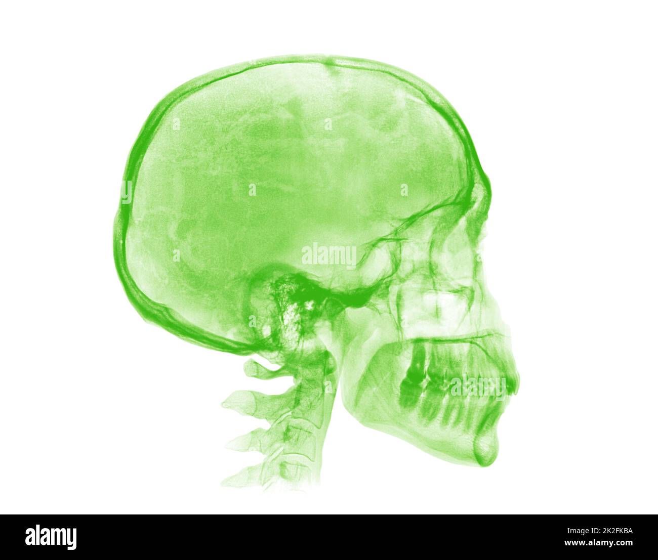 Cranio umano. Immagine radiografica verde su sfondo bianco Foto Stock
