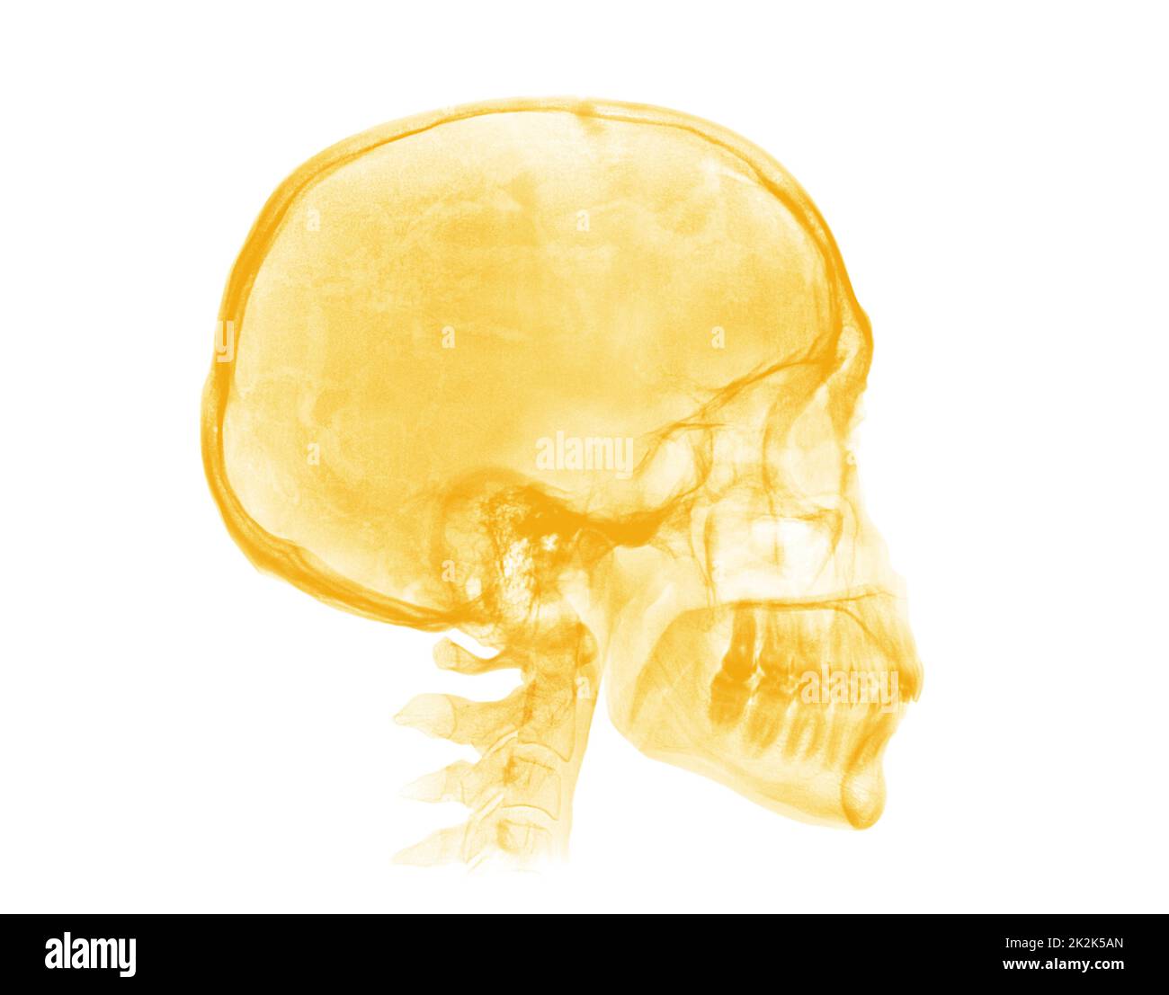 Cranio umano. Immagine radiografica gialla su sfondo bianco Foto Stock