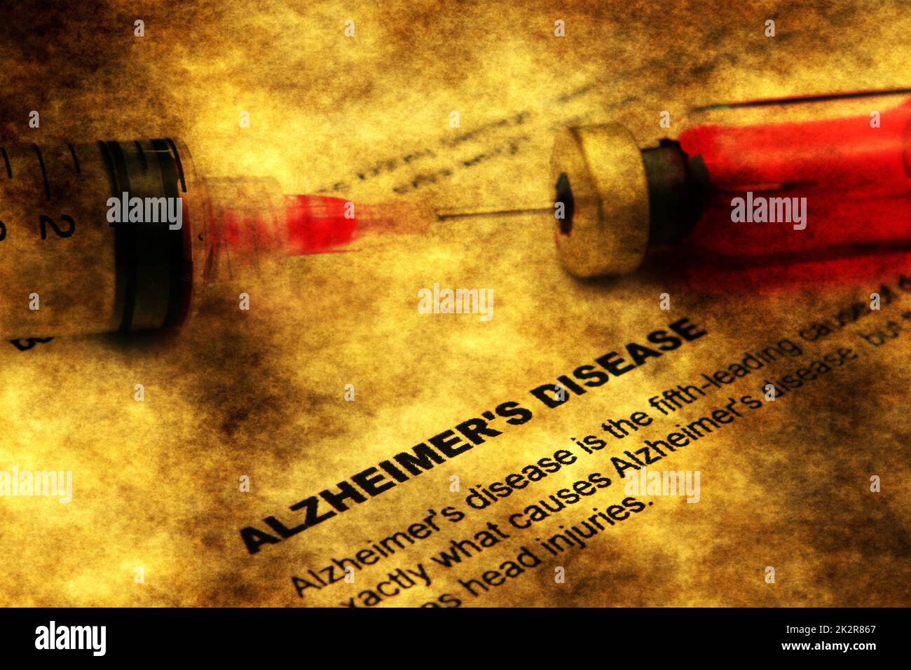 Malattia di Alzheimer Foto Stock