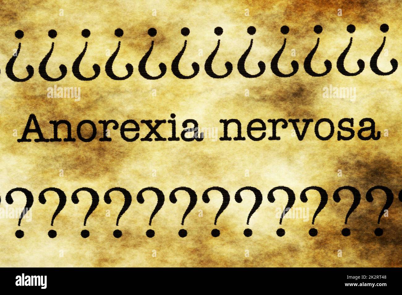L anoressia nervosa Foto Stock