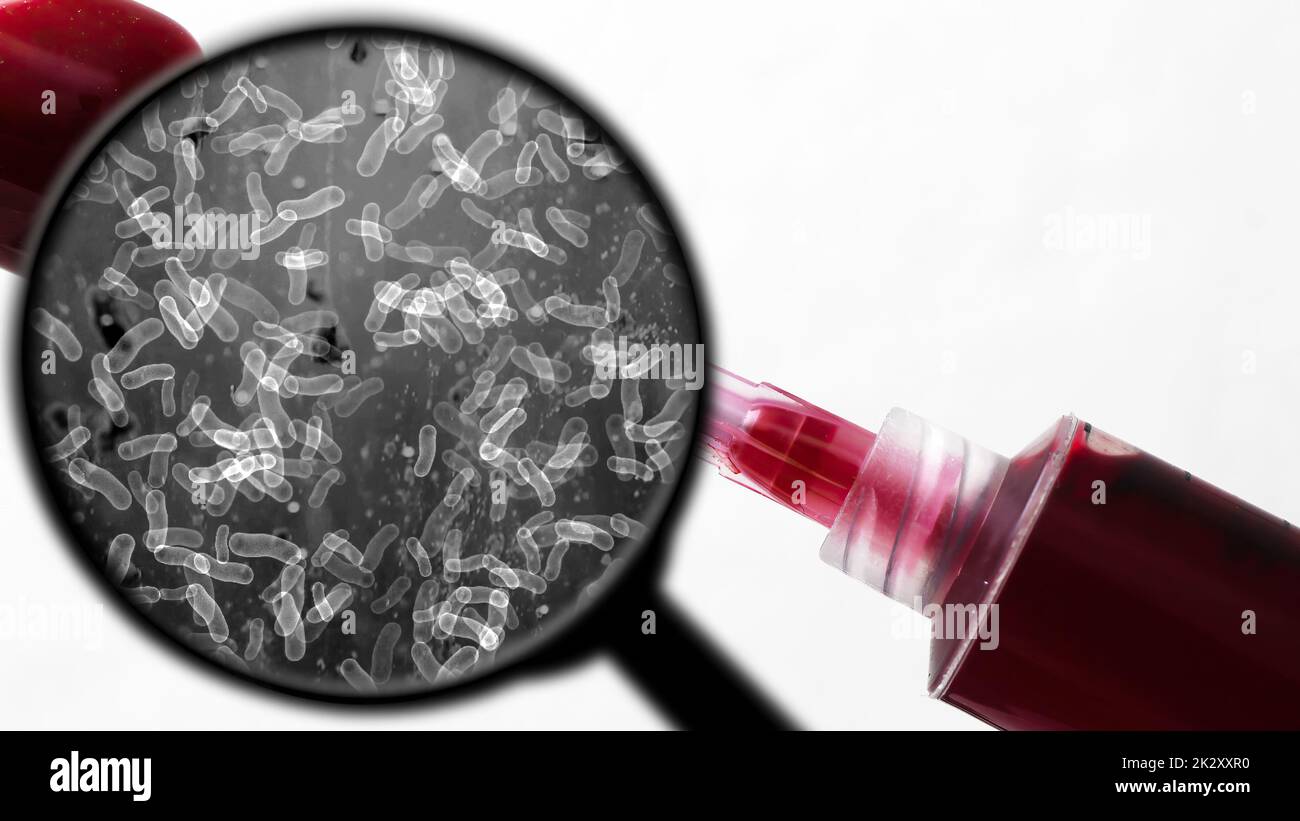 Ricerca di batteri nel sangue Foto Stock