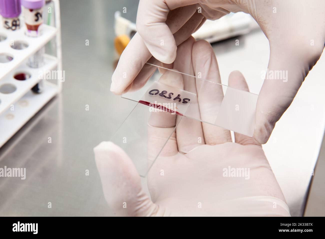 Scienziato che prepara uno striscio di midollo osseo in laboratorio. Striscio di sangue. Foto Stock