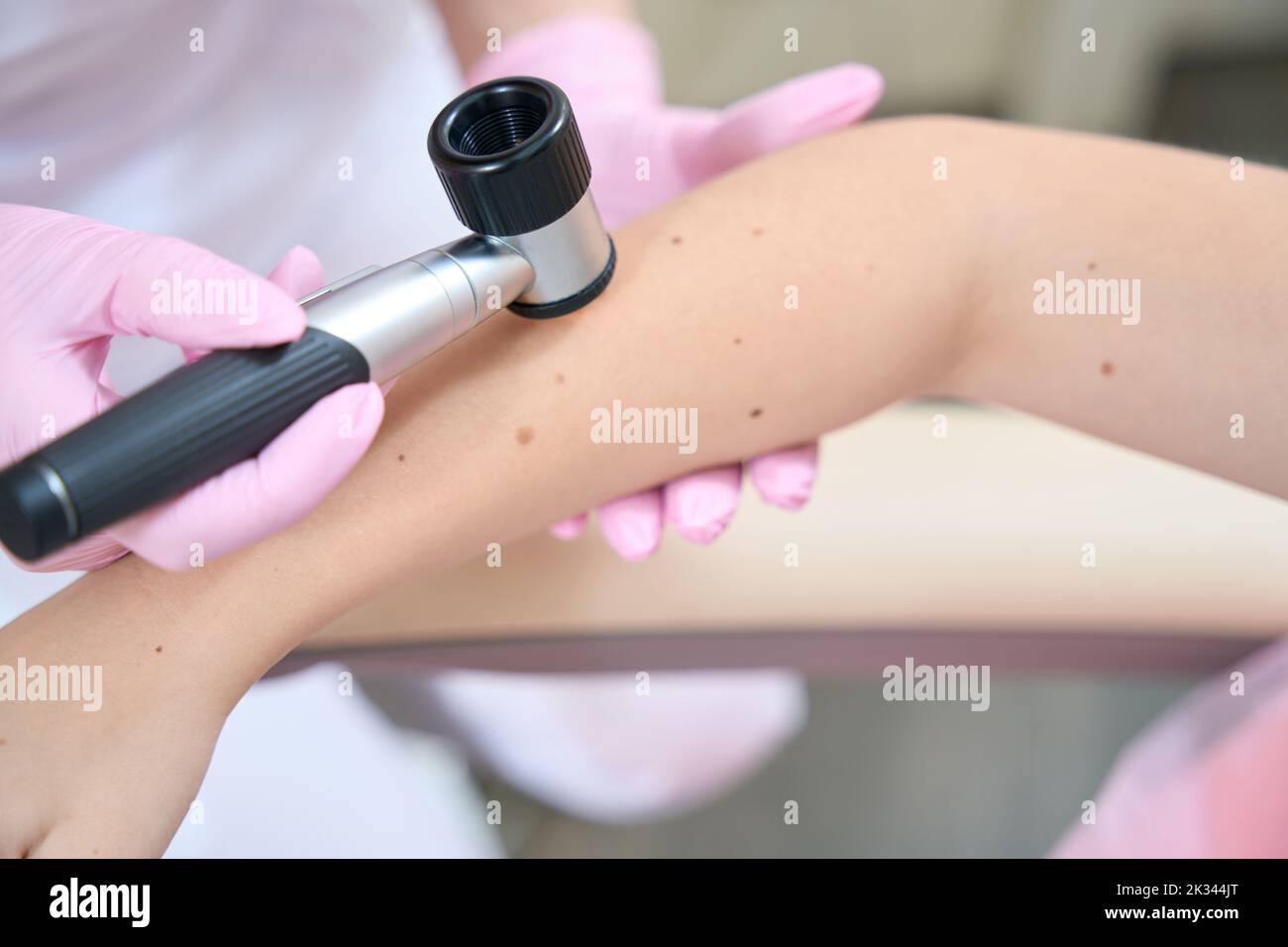 Mani ravvicinate dell'estetista esaminano la pelle sul braccio con il dermatoscopio Foto Stock