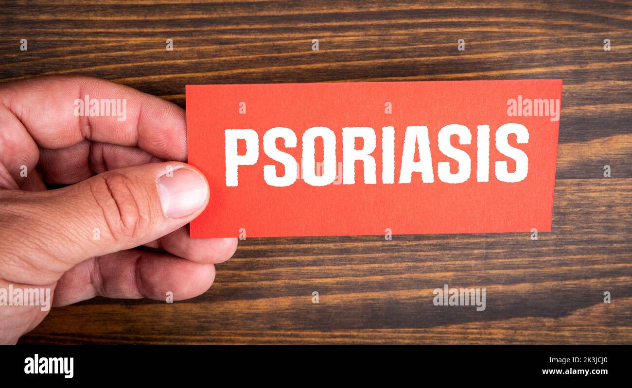Psoriasi. Testo su sfondo rosso. Pezzo di carta in mano di un uomo. Foto Stock