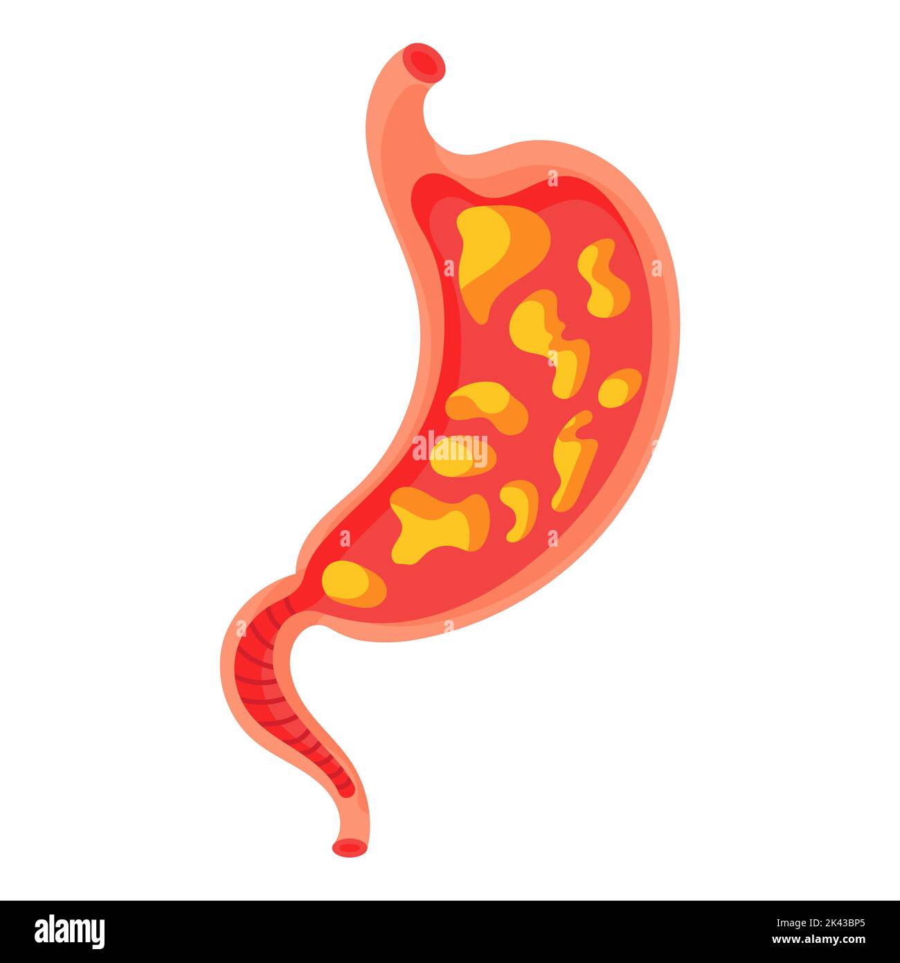 Stomaco pieno. Pesantezza dello stomaco, gonfiore, dolore nel tratto alimentare e bruciore di stomaco acido. Problemi duodenali e salute degli organi umani cartone digerito Illustrazione Vettoriale