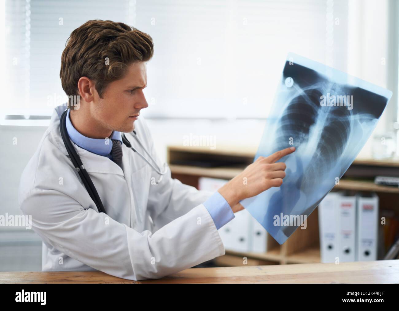 Cercando la causa... un giovane medico che esamina una radiografia toracica. Foto Stock