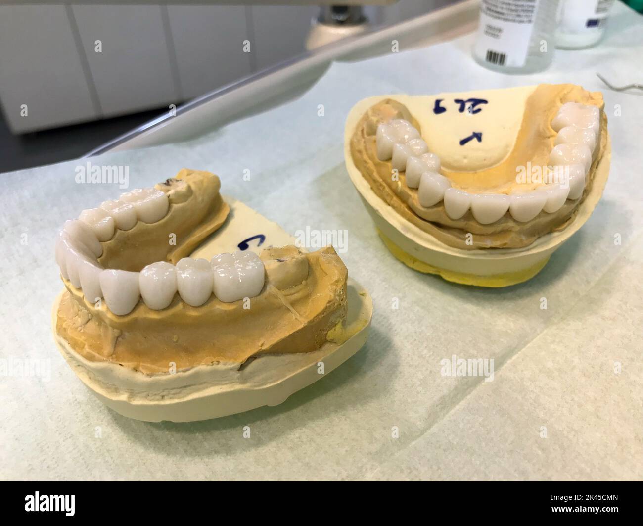 Corone dentali di Zirconia. Protesi ortodontiche Foto Stock