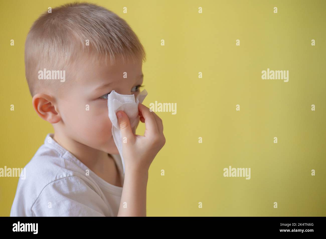 Un bambino in una T-shirt bianca su sfondo giallo, soffiando il naso. Bambino malato con tovagliolo. Capretto allergico, stagione influenzale. Capretto con rinite fredda, freddo. L Foto Stock