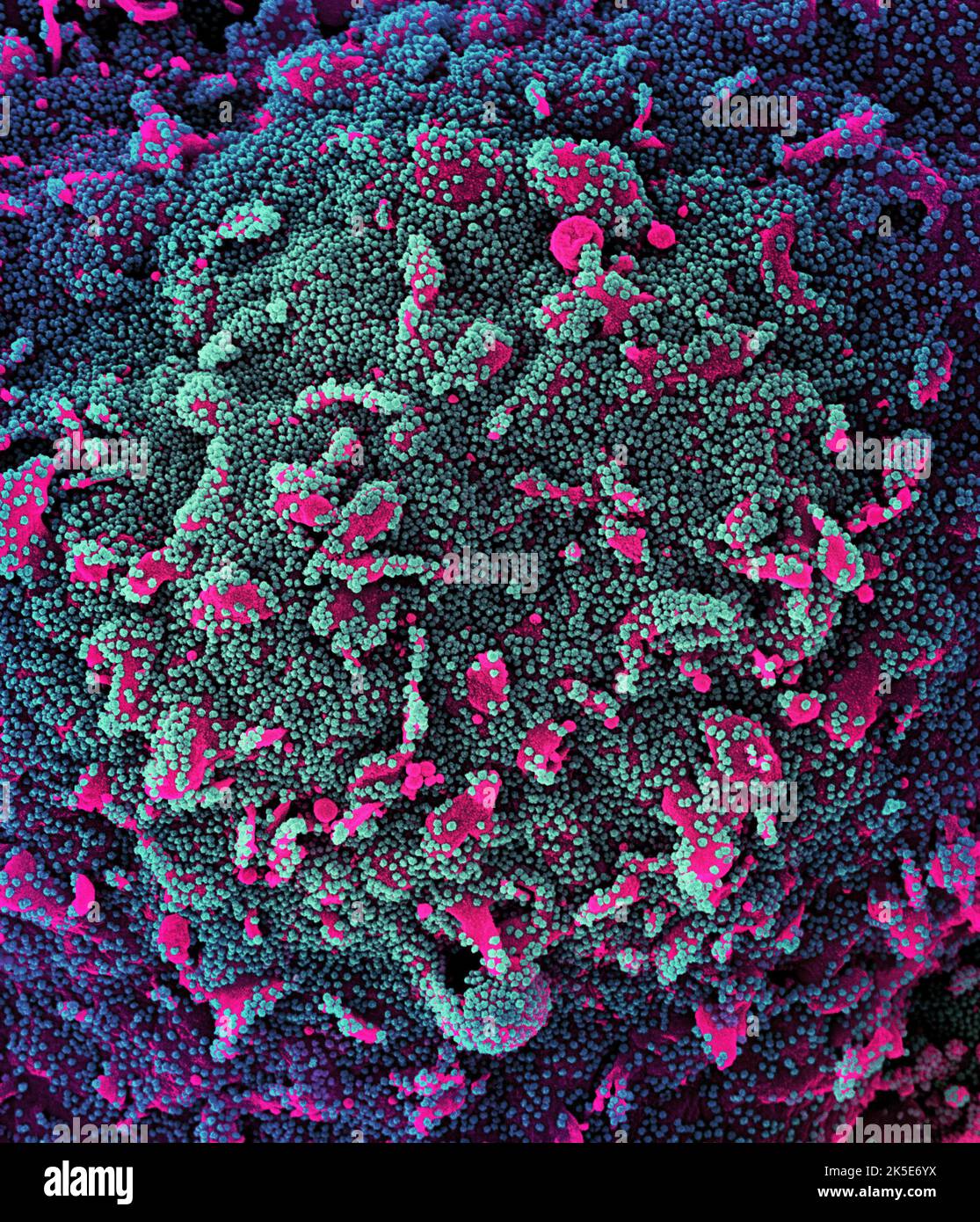 Nuovo Coronavirus SARS-COV-2. Micrografia elettronica a scansione colorata di una cellula (rosa) fortemente infettata con particelle di virus SARS-COV-2 (teal e viola), isolata da un campione di paziente. Immagine acquisita presso la NIAID Integrated Research Facility (IRF) a Fort Detrick, Maryland. Una versione composita ottimizzata e migliorata di sei immagini a scansione di micrografia elettronica, Credit: NIAID Foto Stock