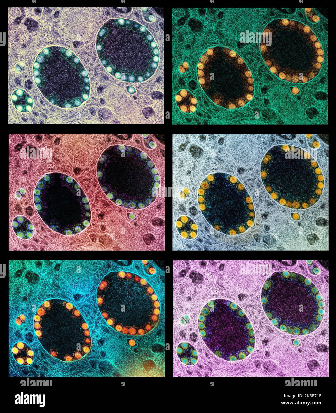 Nuove particelle virali di Coronavirus SARS-COV-2. Un composito unico di 6 immagini di micrografia elettronica a trasmissione di particelle di virus SARS-COV-2 all'interno di endosomi di una cellula epiteliale nasale olfattiva fortemente infettata. Immagini acquisite presso la NIAID Integrated Research Facility. Una versione composita ottimizzata e migliorata delle immagini 6 a scansione di micrografia elettronica, Credit: NIAID / Alamy Live News Foto Stock