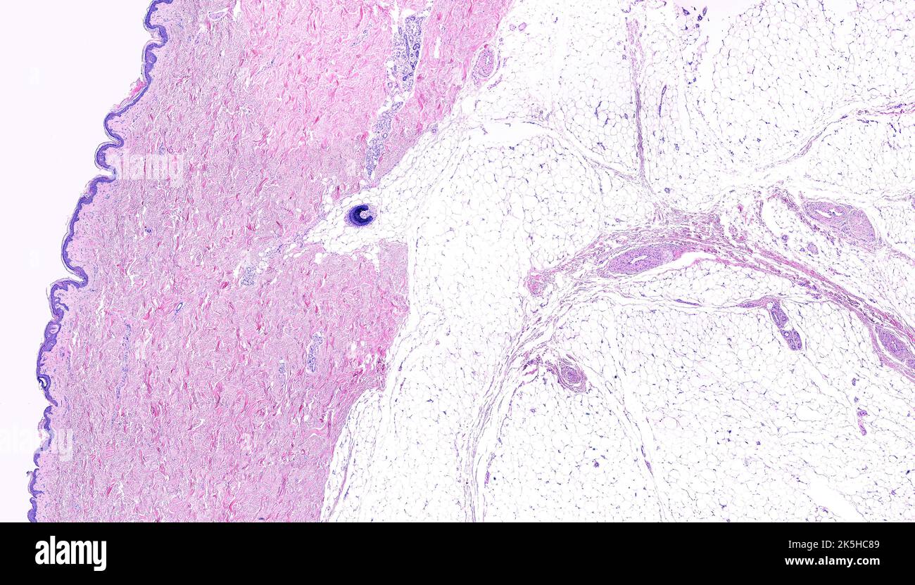 Microscopio ottico a bassa potenza di pelle sottile che mostra la forma da sinistra a destra, l'epidermide, un derma molto spesso che mostra ghiandole sudoripare e un foll piliferi Foto Stock