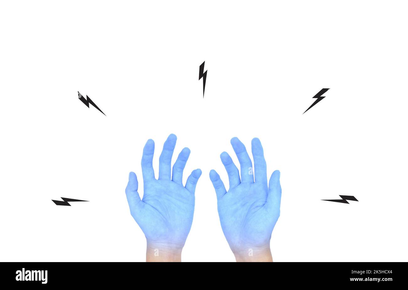 Due mani aperte di colore azzurro del giovane asiatico. Concetto di mano fredda e maldestra. Foto Stock