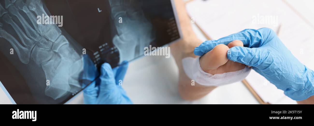 Il medico tiene i raggi X con la gamba del paziente smontata sul tavolo Foto Stock