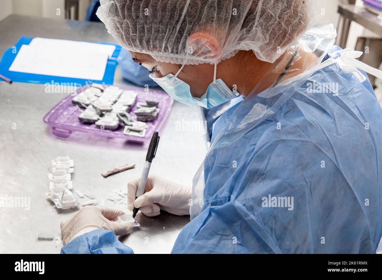 Lo scienziato prepara blocchetti di paraffina contenenti tessuto bioptico per il sezionamento. Laboratorio di patologia. Diagnosi del cancro. Foto Stock