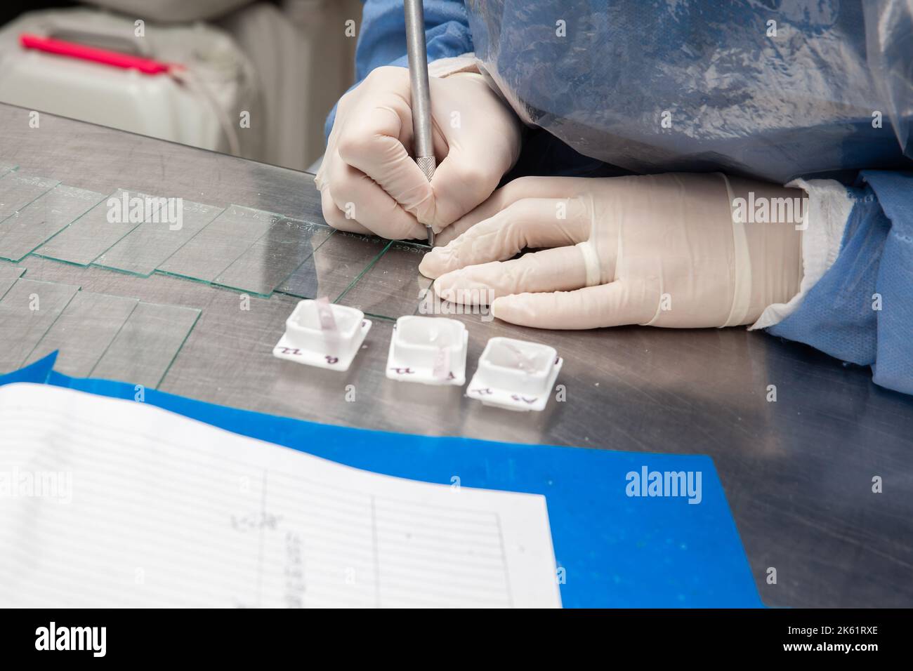 Lo scienziato prepara blocchetti di paraffina contenenti tessuto bioptico per il sezionamento. Laboratorio di patologia. Diagnosi del cancro. Foto Stock