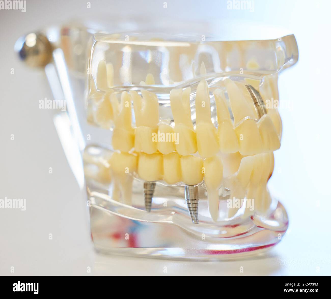 Denti perfettamente proporzionati. uno stampo di denti in un dentista ufficio. Foto Stock