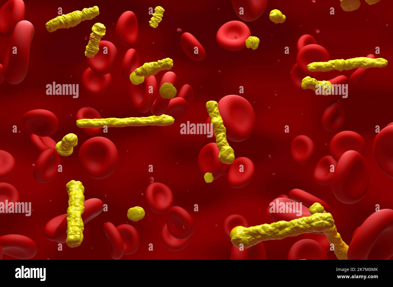 Cristalli di colesterolo nel flusso sanguigno - vista isometrica 3D illustrazione Foto Stock