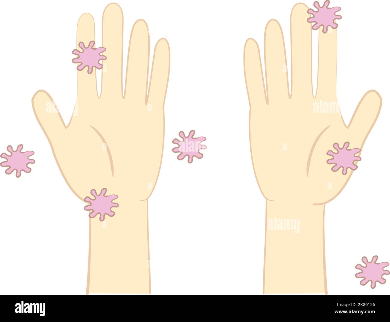 Illustrazione della mano con coronavirus attaccato Illustrazione Vettoriale