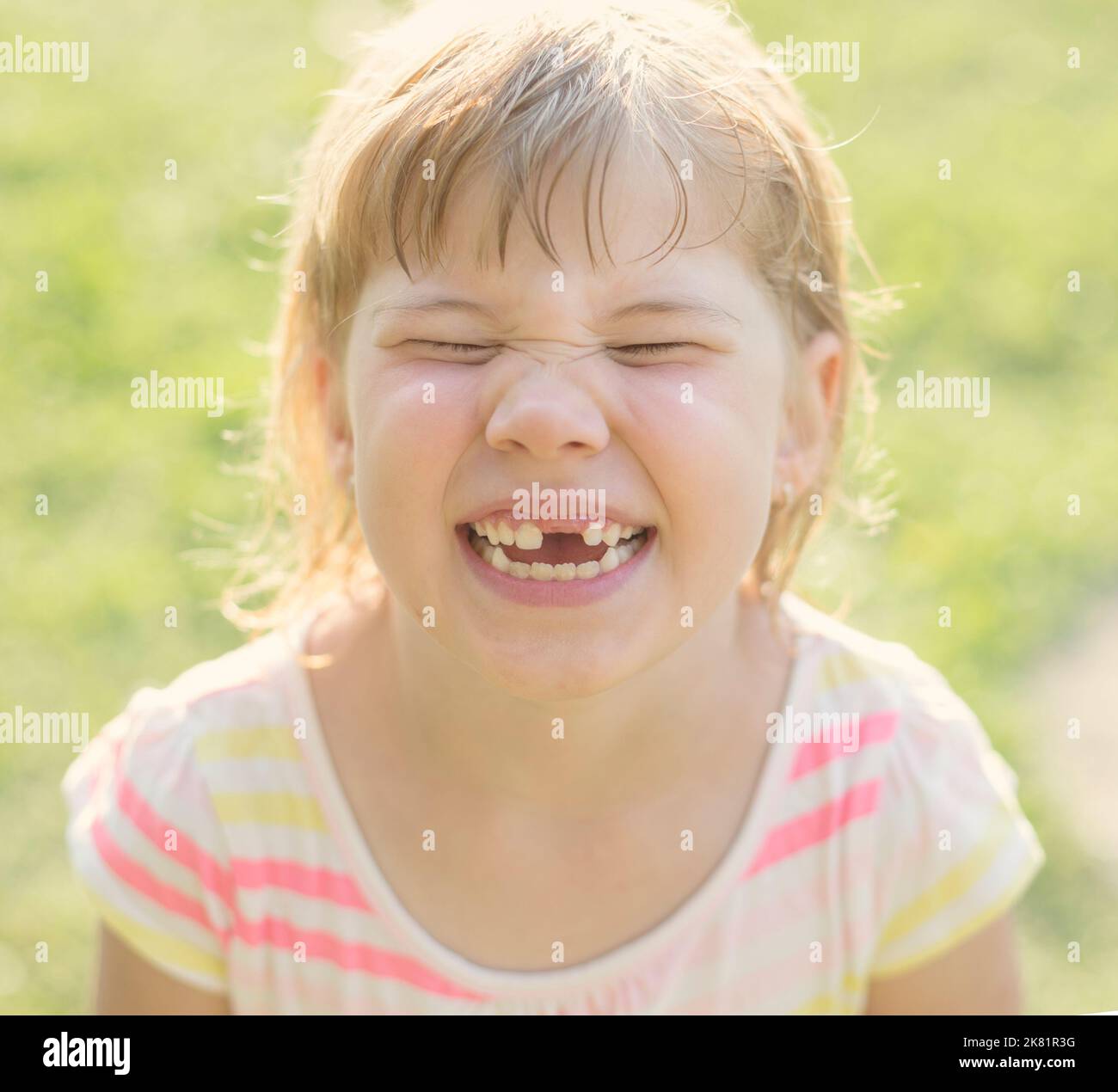 Cute bambino giovane fare grimace con denti mancanti Foto Stock