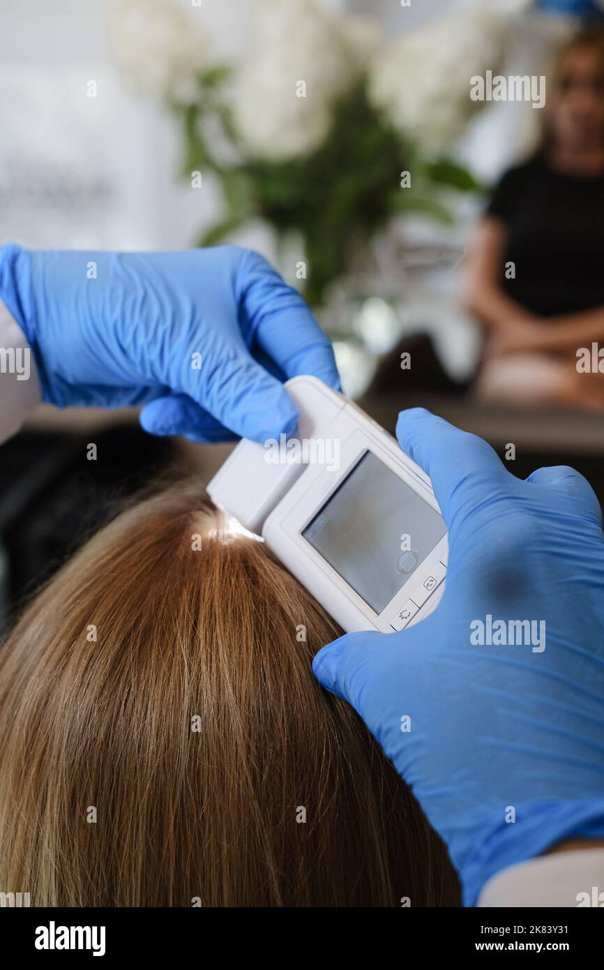 Il medico esamina la pelle della testa di una ragazza giovane con il sistema speciale dell'apparecchiatura di dermatologia, il concetto di perdita dei capelli e di tricologia Donna che analizza i capelli con Foto Stock