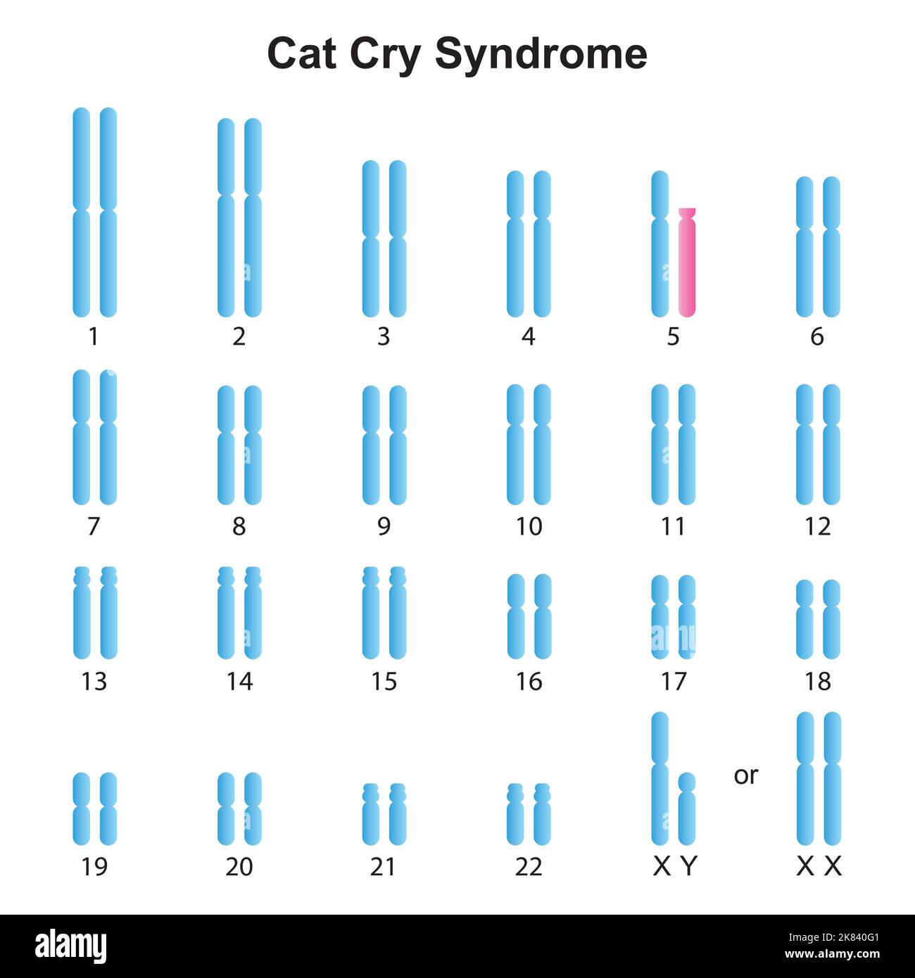 Progettazione scientifica del Karyotype della sindrome di Cry del gatto. Simboli colorati. Illustrazione vettoriale. Illustrazione Vettoriale