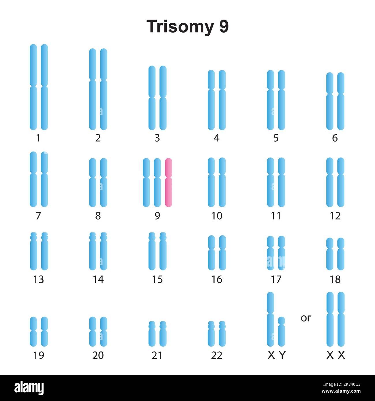 Progettazione scientifica del cariotipo Trisomy 9. Simboli colorati. Illustrazione vettoriale. Illustrazione Vettoriale